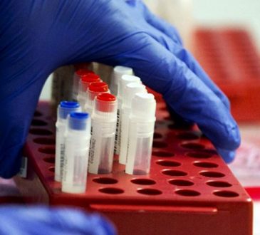 Escasez de insumos en laboratorios autorizados para procesar pruebas de Covid-19