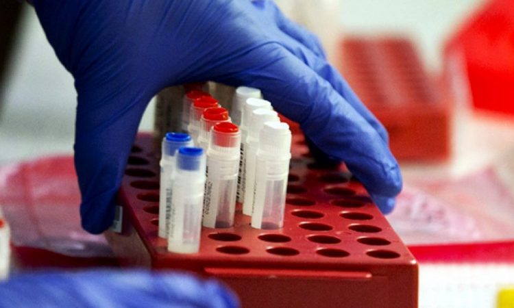 Escasez de insumos en laboratorios autorizados para procesar pruebas de Covid-19
