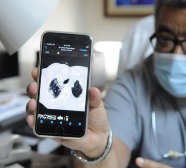 Médico dominicano creó ventilador que ayuda a la recuperación de pacientes con Covid-19 sin intubarlos