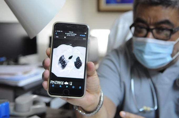 Médico dominicano creó ventilador que ayuda a la recuperación de pacientes con Covid-19 sin intubarlos