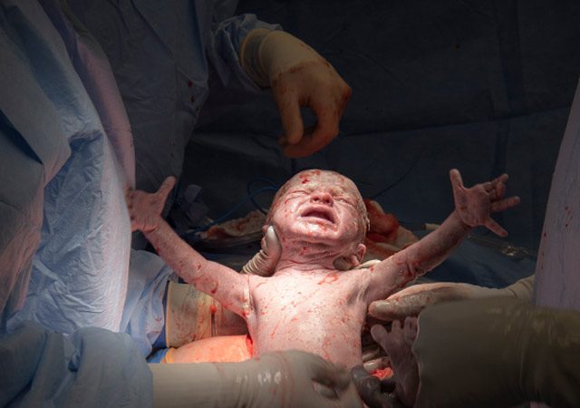 Segundo bebé nació en la Cleveland Clinic luego de un transplante de vientre de donante fallecida