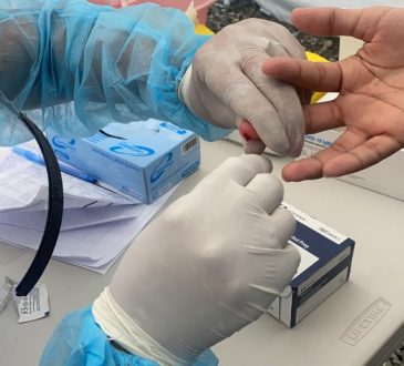 SNS informó que en 21 centros de la Red Pública de Salud toman muestras para pruebas PCR y rápidas