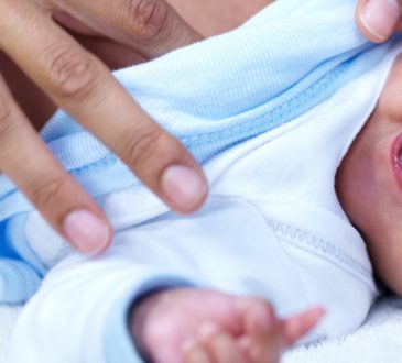 Jornada gratuita de cirugías para pacientes con labio y paladar hendido iniciará en noviembre en el Hospital Gautier