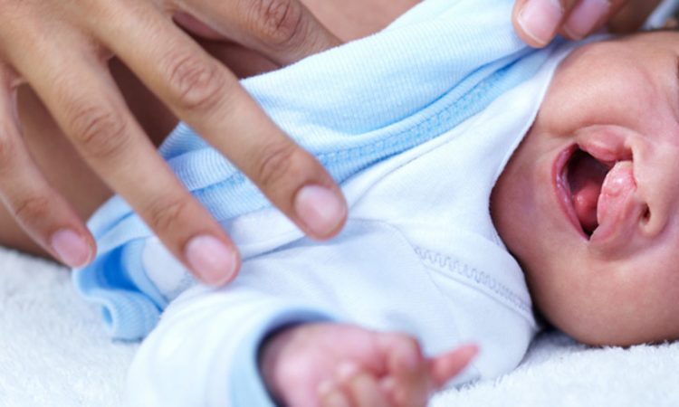 Jornada gratuita de cirugías para pacientes con labio y paladar hendido iniciará en noviembre en el Hospital Gautier Jornada gratuita de cirugías para pacientes con labio y paladar hendido iniciará en noviembre en el Hospital Gautier
