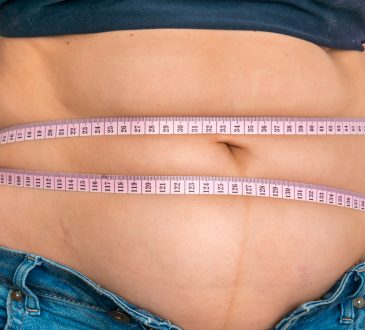 Especialista advirtió sobre riesgos de desarrollar anemia en pacientes con procedimientos invasivos contra la obesidad