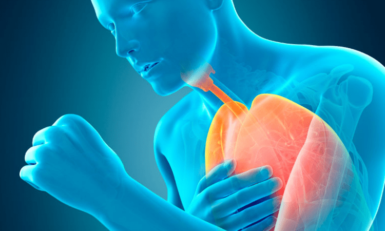 Tratamiento avanzado con válvulas endobronquiales mejora calidad de vida de pacientes con EPOC Tratamiento avanzado con válvulas endobronquiales mejora calidad de vida de pacientes con EPOC