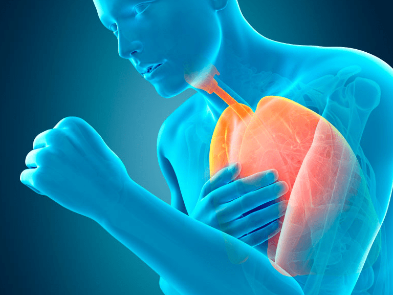 Tratamiento avanzado con válvulas endobronquiales mejora calidad de vida de pacientes con EPOC Tratamiento avanzado con válvulas endobronquiales mejora calidad de vida de pacientes con EPOC