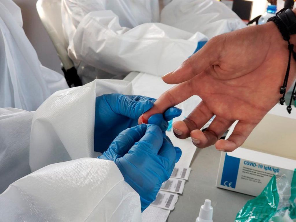 Tesorería de la Seguridad Social realiza operativo de pruebas PCR contra la Covid-19