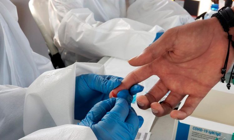 Tesorería de la Seguridad Social realiza operativo de pruebas PCR contra la Covid-19 Tesorería de la Seguridad Social realiza operativo de pruebas PCR contra la Covid-19