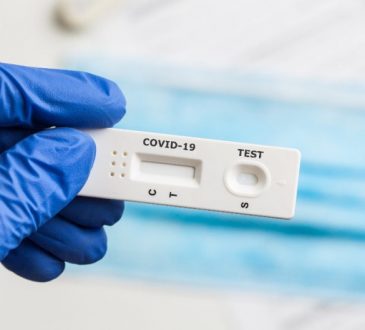 DIGEMAPS regulará comercialización de pruebas PCR a partir de febrero