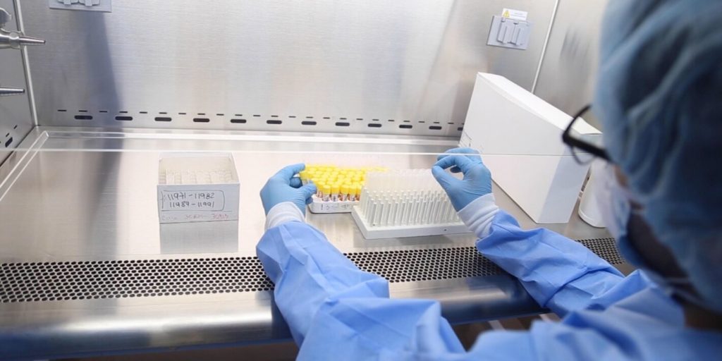 Arias resaltó mejora del procesamiento y rapidez de entrega de pruebas PCR en el Laboratorio Nacional
