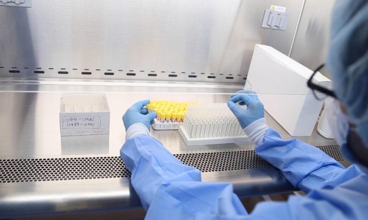Arias resaltó mejora del procesamiento y rapidez de entrega de pruebas PCR en el Laboratorio Nacional Arias resaltó mejora del procesamiento y rapidez de entrega de pruebas PCR en el Laboratorio Nacional