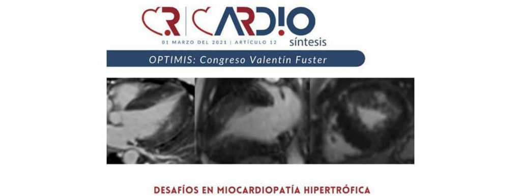 Cardiosíntesis publicó análisis sobre la miocardiopatía hipertrófica