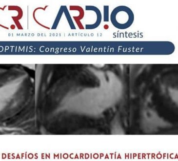 Cardiosíntesis publicó análisis sobre la miocardiopatía hipertrófica
