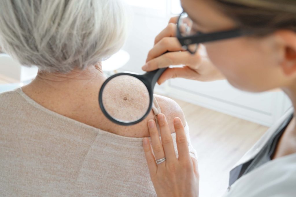 Instituto dermatológico promoverá jornada para detección temprana de cáncer de piel en módulos gratuitos Instituto dermatológico promoverá jornada para detección temprana de cáncer de piel en módulos gratuitos