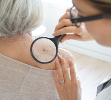 Instituto dermatológico promoverá jornada para detección temprana de cáncer de piel en módulos gratuitos