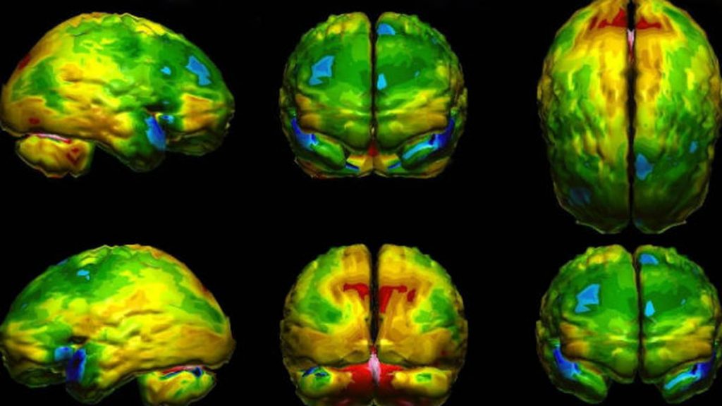 Investigadores publicaron tratamiento cerebral para modificar miedos, gustos y mejorar la confianza