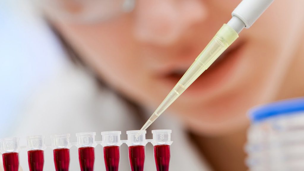 Janssen presentó propuesta para mejorar la vida de los pacientes con cáncer en la sangre Janssen presentó propuesta para mejorar la vida de los pacientes con cáncer en la sangre