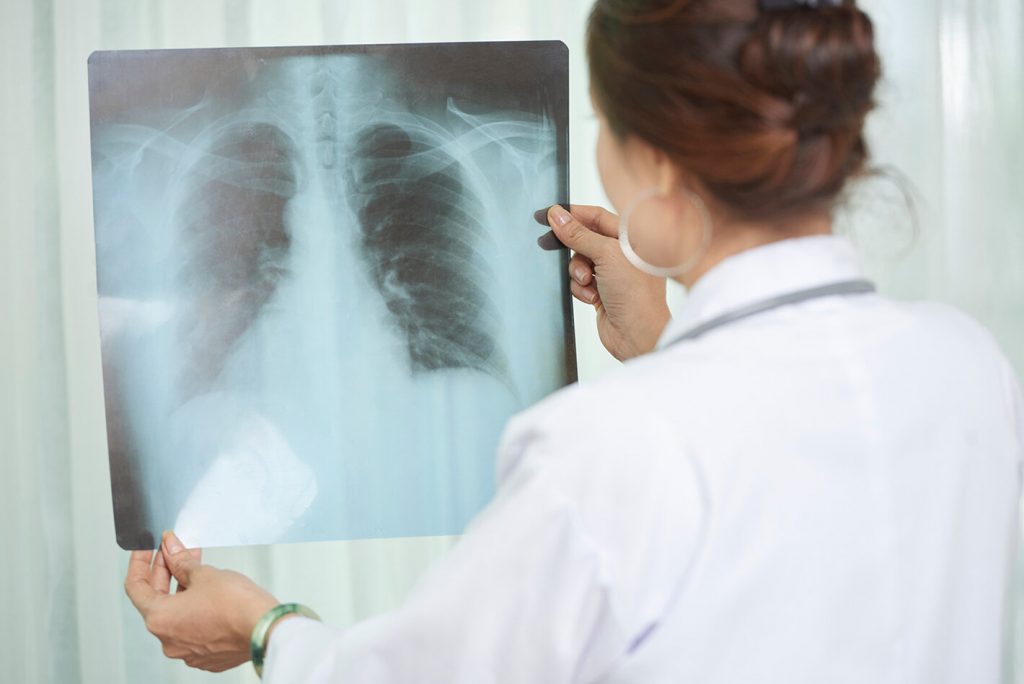 Estados Unidos financió proyecto dominicano para desarrollar tratamiento que cure la tuberculosis en menos tiempo Estados Unidos financió proyecto dominicano para desarrollar tratamiento que cure la tuberculosis en menos tiempo