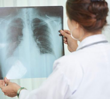 Estados Unidos financió proyecto dominicano para desarrollar tratamiento que cure la tuberculosis en menos tiempo
