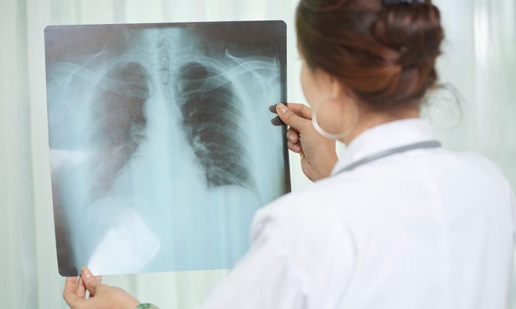 Estados Unidos financió proyecto dominicano para desarrollar tratamiento que cure la tuberculosis en menos tiempo