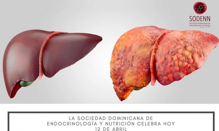 SODENN alertó sobre efectos de la enfermedad hepática