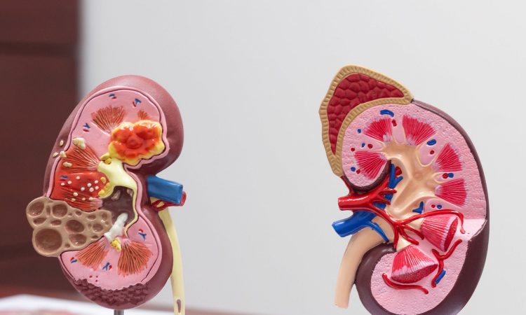 MacroTech dio a conocer innovadora prueba para pronosticar estado renal de diabéticos