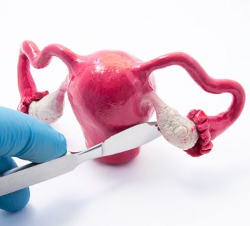 AstraZeneca y MSD presentaron tratamiento que reduce el 70% del avance en cáncer de ovarios