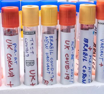 Investigadores hallaron posible causa por la cual se pueden generar coágulos en inoculados contra COVID-19