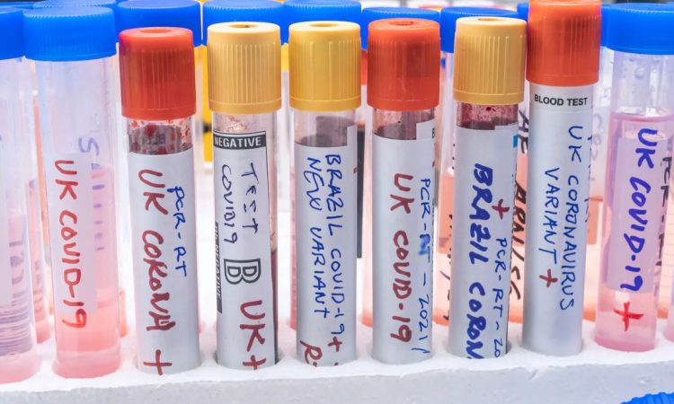 Investigadores hallaron posible causa por la cual se pueden generar coágulos en inoculados contra COVID-19