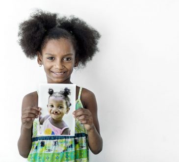 Operación sonrisa beneficiará a 25 niños con su vigésimo octava misión médica