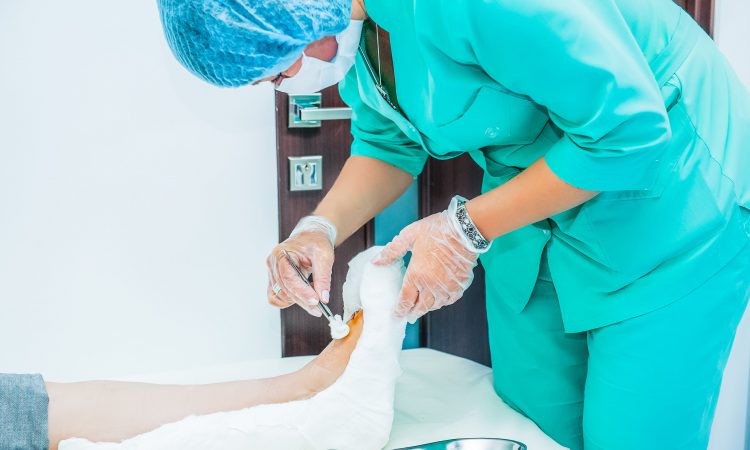 CuraTech señaló los beneficios del desbridamiento de quemaduras y lesiones de la piel
