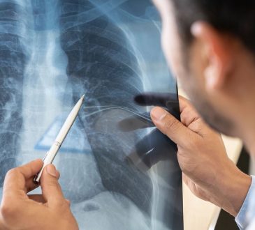 SDP advirtió que infecciones respiratorias agudas son mortales en menores de cinco años
