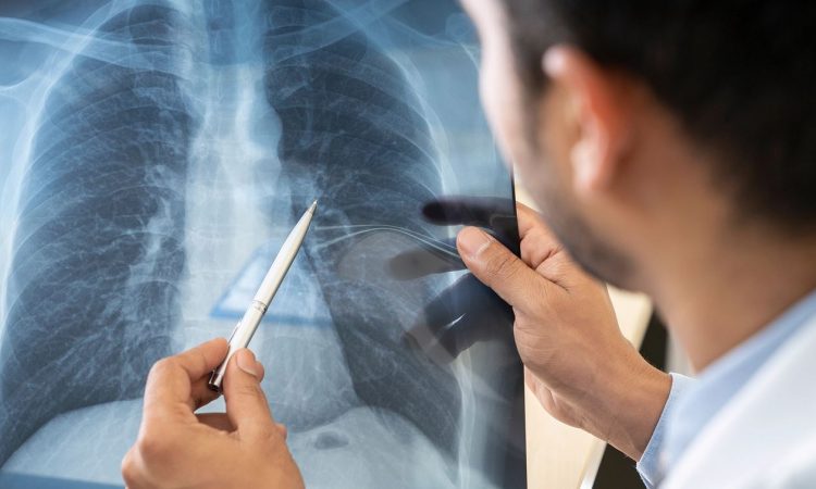 SDP advirtió que infecciones respiratorias agudas son mortales en menores de cinco años SDP advirtió que infecciones respiratorias agudas son mortales en menores de cinco años