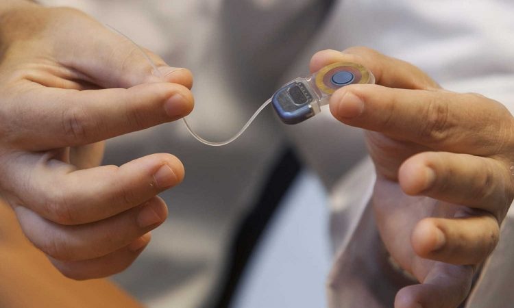 Hospital Gautier aspira ser el primer centro público en devolver la audición a miles de ciudadanos