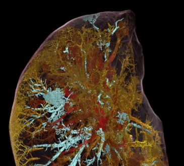 HiP-CT, los rayos X más brillantes del mundo muestran el daño pulmonar causado por el Covid-19
