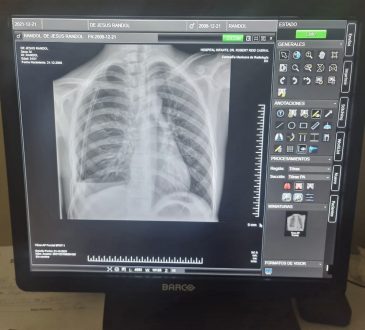 Reid Cabral optimiza servicio de radiología con inversión de RD$2 millones