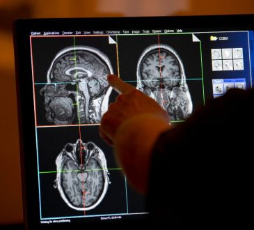 Cleveland Clinic lanza primer estudio cerebral para prevenir enfermedades neurológicas