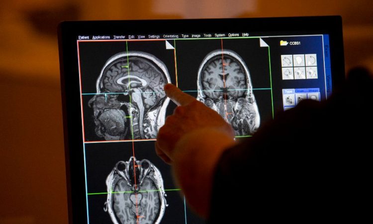 Cleveland Clinic lanza primer estudio cerebral para prevenir enfermedades neurológicas Cleveland Clinic lanza primer estudio cerebral para prevenir enfermedades neurológicas
