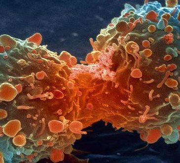 Muertes por cáncer en el mundo aumentaron 20% en la última década