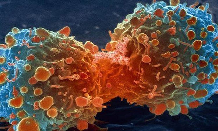 Muertes por cáncer en el mundo aumentaron 20% en la última década