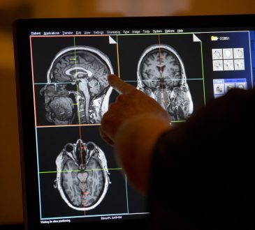 Cleveland Clinic lanza primer estudio cerebral para prevenir enfermedades neurológicas
