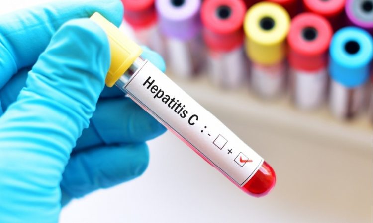 Gilead llama a la población a hacerse la prueba de Hepatitis C para poder detectarla oportunamente