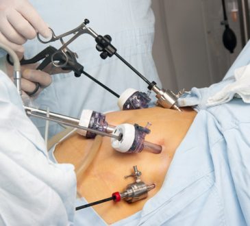 La cirugía bariátrica reduce el riesgo de sufrir enfermedades cardiovasculares, según estudio