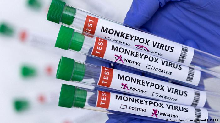 OMS definirá situación sanitaria de viruela del mono