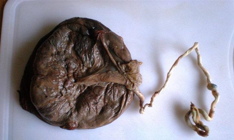 Ginecólogos advierten riesgos sobre la placentofagia