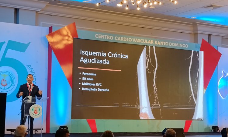 República Dominicana cuenta con altos niveles tecnológicos endovasculares