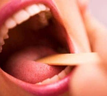 Especialista alerta sobre secuelas de la amigdalitis bacteriana