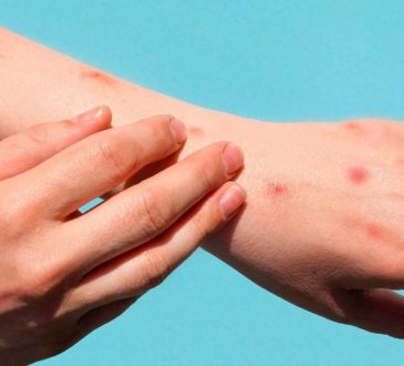 Epidemiólogo llama a reforzar medidas sanitarias en los aeropuertos por viajeros de USA, Colombia y Ecuador