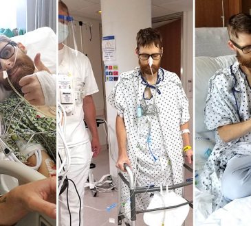 Cleveland Clinic realiza el primer trasplante de múltiples órganos para el cáncer de apéndice raro